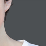 Uniform Background Replacement